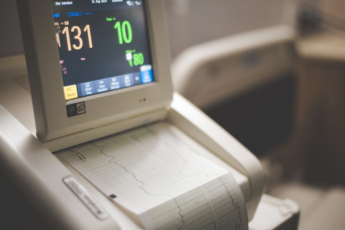 ECG and cardiac diagnostic monitoring at our heart hospital in Hyderabad
